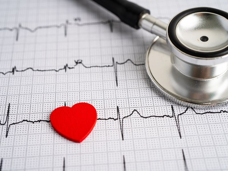 Arytmia serca – co to za choroba i jak ją leczyć?